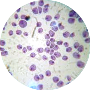 Trichomonas vaginalis